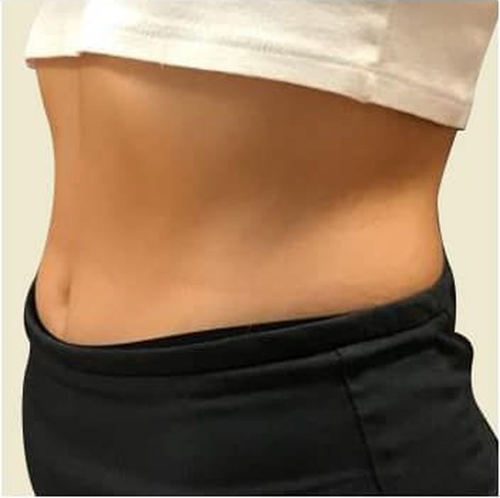 After treatment