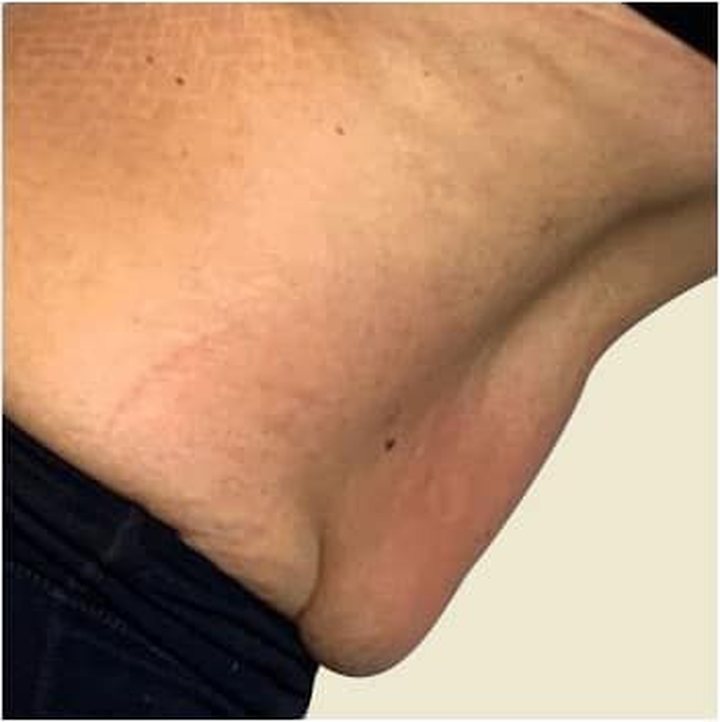 Before treatment