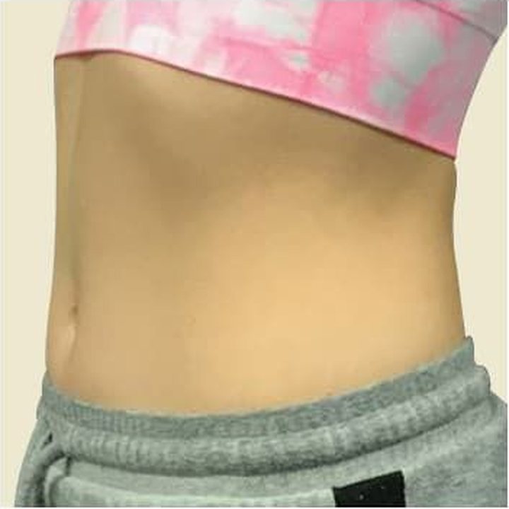 Before treatment