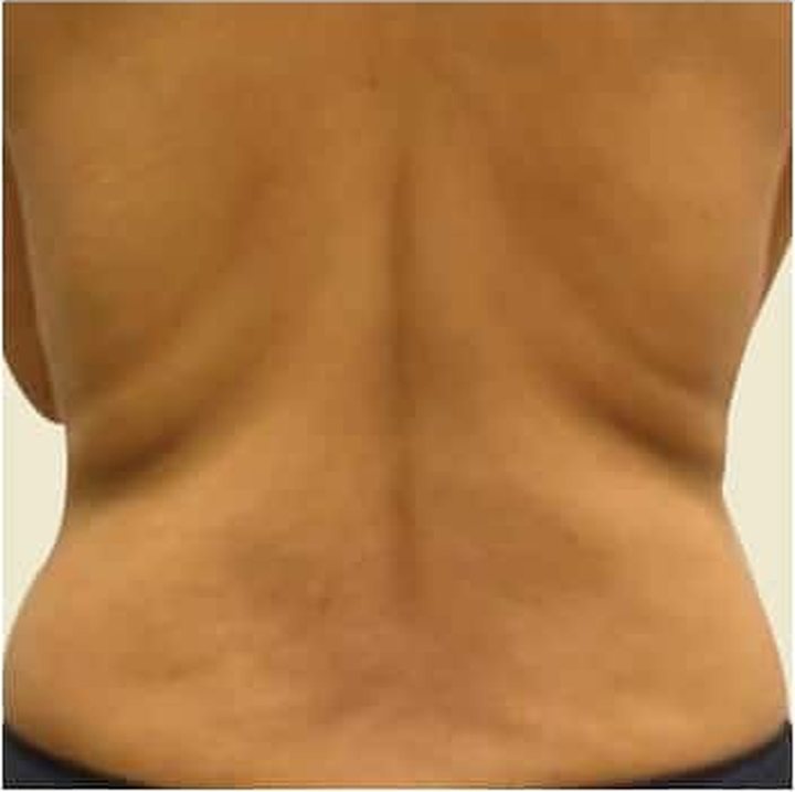 Before treatment
